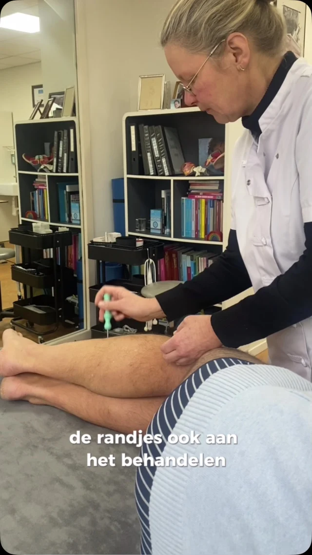 Heb je vaak last van strakke of stijve onderbenen? 

Met de Sylo-pen kun je ook bindweefsel, spanning tussen de spieren losmaken. Bijvoorbeeld spanning tussen het scheenbeen en de tibialis anterior (de voorste scheenbeenspier) aanpakken. Door zowel de spier als het weefsel tussen de spier te behandelen, creëer je meer ruimte in je onderbeen.

Het mooie is: zodra het weefsel aan de voorkant weer soepel beweegt, merk je dat dit ook doorwerkt naar de achterkant van je been. Je hele onderbeen voelt losser aan, waardoor bewegen weer een stuk makkelijker en fijner wordt. 🙌

Dit is ook heel belangrijk om te doenbij shin splints. Dit is een veelvoorkomende blessure die pijn veroorzaakt aan de voorkant of binnenkant van het scheenbeen. Het ontstaat door overbelasting van de spieren, pezen en het botvlies in het onderbeen, vaak door hardlopen, springen of intensieve sporten zoals skiën.

#sylopen #sytskelohof #spierpijn #fysiotherapie #pijnklachten #sport #triggerpoint #rugklachten #sportblessure #shinplints #rugklachtenverminderen #fysioterapeut #fysio #natuurlijkgezond
#massagetherapy #pijnvrij #botvliesontsteking #bindweefselmassage